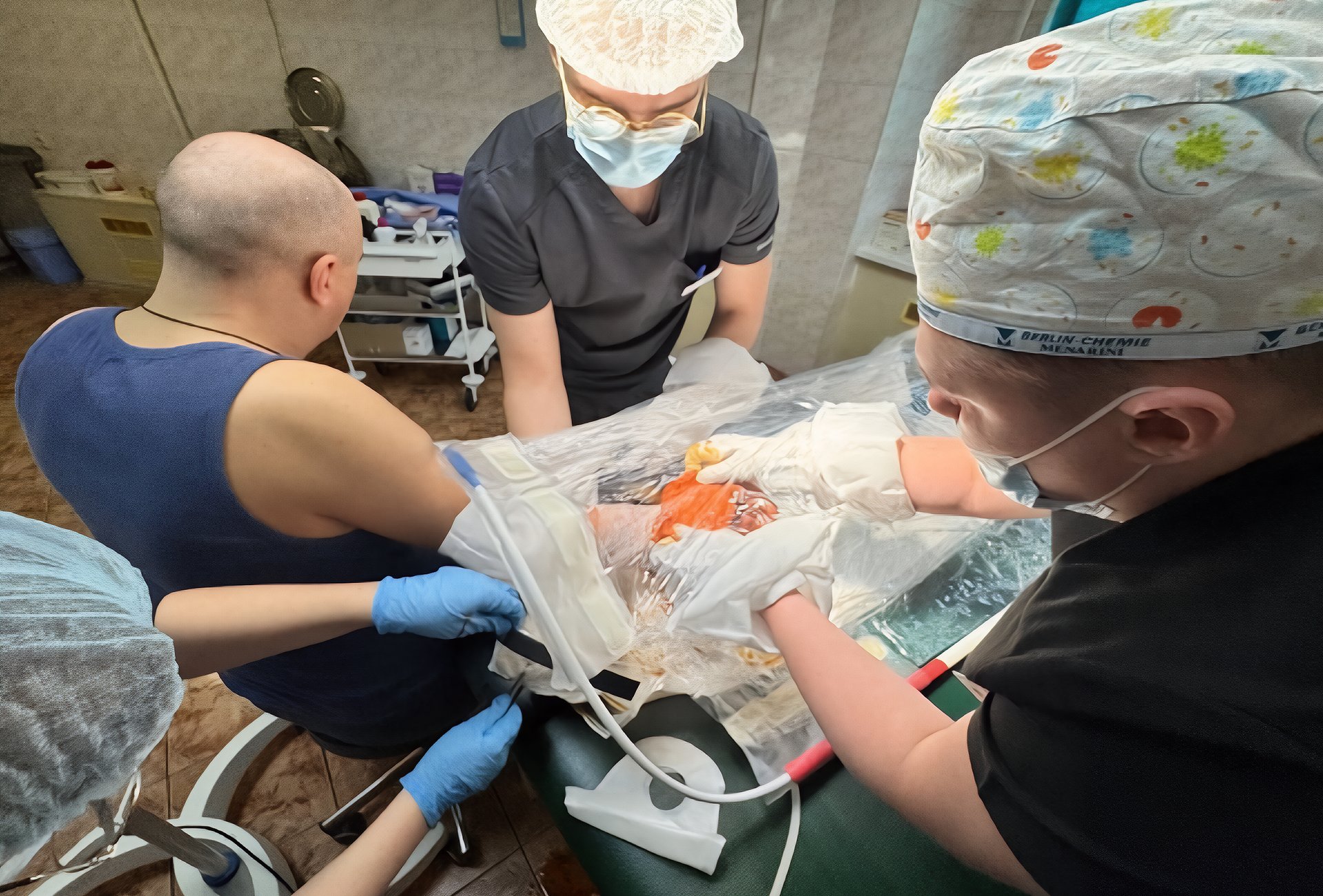 Wound VAC Removal & Debridement